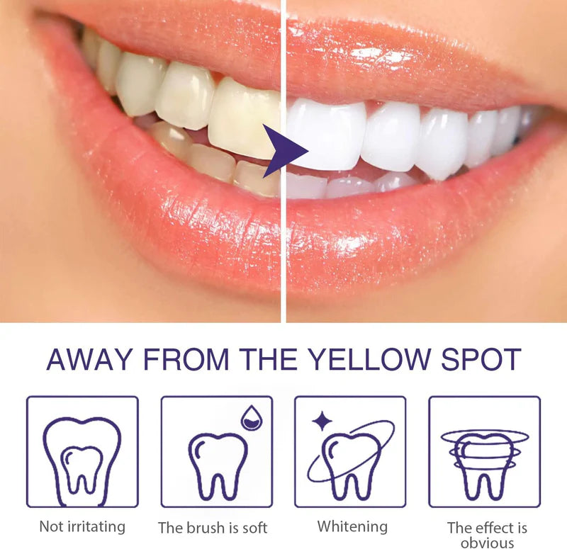 Lanthome - V34 Teeth Whitening Pen